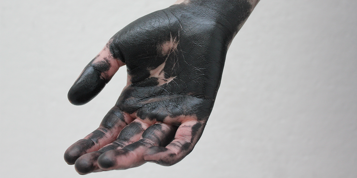 An outstretched hand with palm facing upward. Black paint covers the hand, beginning at the fingertips and moving down the wrist. Patches of caucation skin can be seen on the palm, in between the fingers, and part of the wrist.